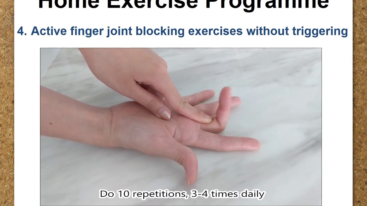 14 Trigger Finger Exercises To Relieve Pain