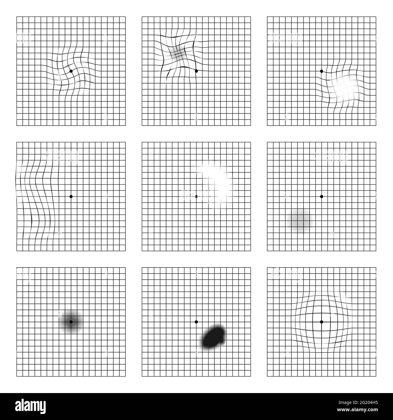printable amsler grid pdf