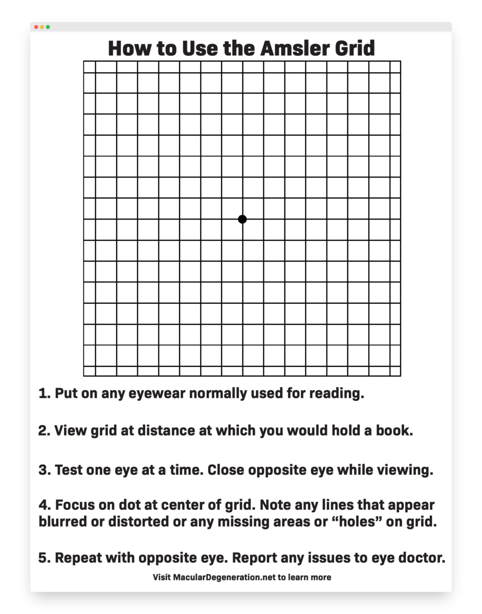 Amsler Grid Vision Tests Visual Acuity Tests New England Low Vision