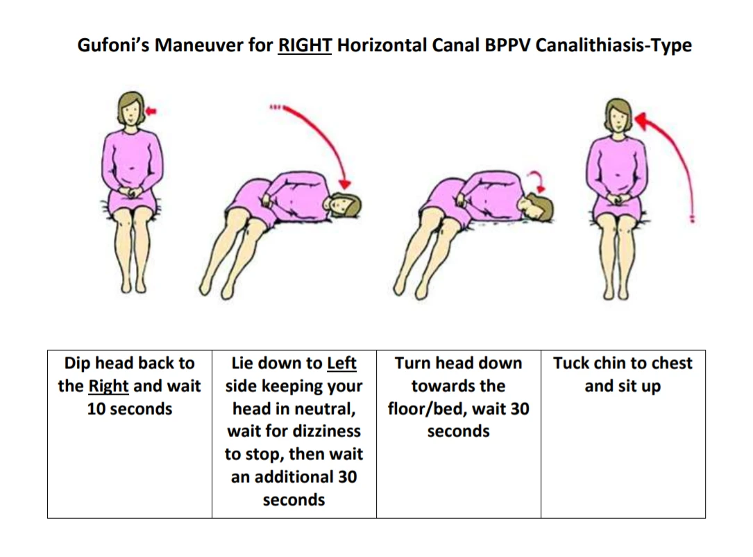 BPPV Resources Vestibular Today