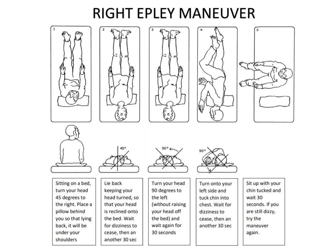 BPPV Resources Vestibular Today