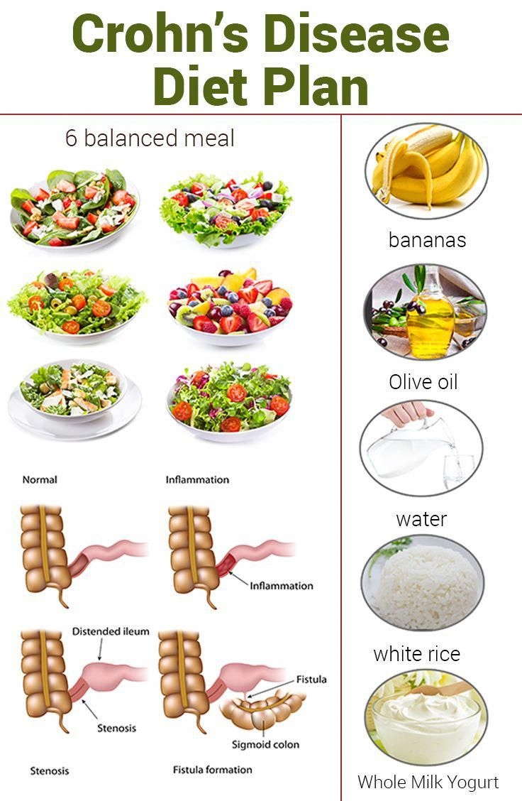 Crohn s Disease Diet Plan Foods To Eat Avoid And Tips