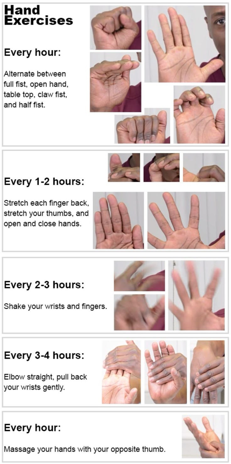 printable trigger finger exercises pdf